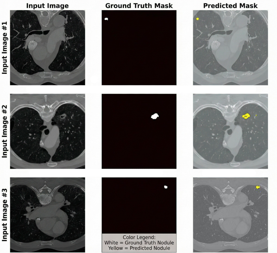 AuraViT-FL Segmentation